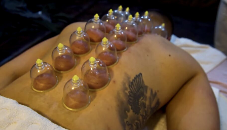 Hidžama terapija ima brojne benefite